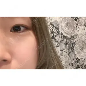 LUNA BEAUTY CLINIC ブリリアスキンクリニック 新宿院口コミ