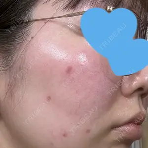 まゆりなclinic 名古屋栄口コミ