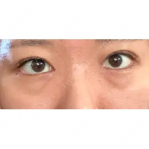 APOLLO BEAUTY CLINIC口コミ