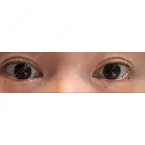 Nebula Clinic ネビュラクリニック 京都院口コミ