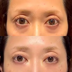 X CLINIC X CLINIC 銀座院口コミ