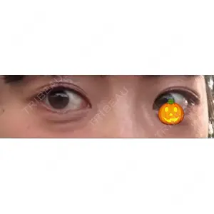 APOLLO BEAUTY CLINIC口コミ