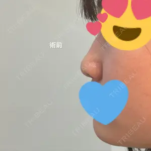 グローバルビューティークリニック グローバルビューティークリニック 大阪院口コミ