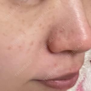 B-LINE CLINIC B-LINE CLINIC 池袋院口コミ