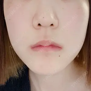 口コミ