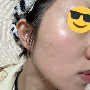 LUNA BEAUTY CLINIC ブリリアスキンクリニック 新宿院口コミ