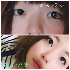 湘南美容クリニック 湘南美容クリニック 柏院口コミ
