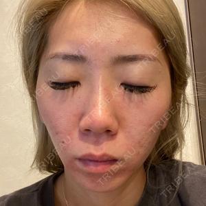 NARU Beauty Clinic NARU Beauty Clinic 【ナルクリ】口コミ