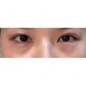 APOLLO BEAUTY CLINIC口コミ