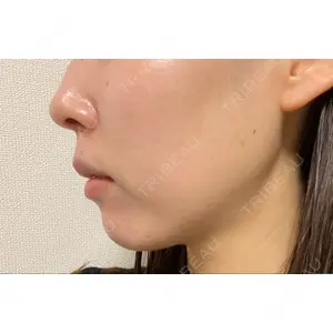 EMMO FACE CLINIC EMMO FACE CLINIC 大阪梅田院口コミ