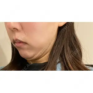 EMMO FACE CLINIC EMMO FACE CLINIC 大阪梅田院口コミ