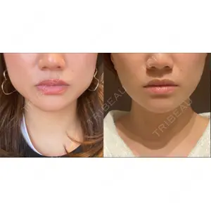 TCB東京中央美容外科 TCB東京中央美容外科 池袋駅前院口コミ