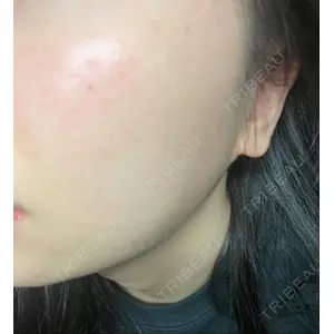 B-LINE CLINIC B-LINE CLINIC 池袋院口コミ