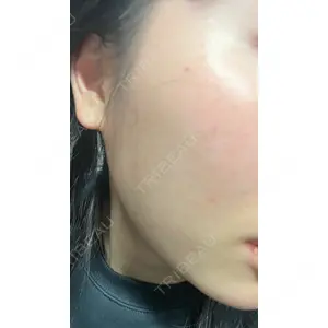B-LINE CLINIC B-LINE CLINIC 池袋院口コミ