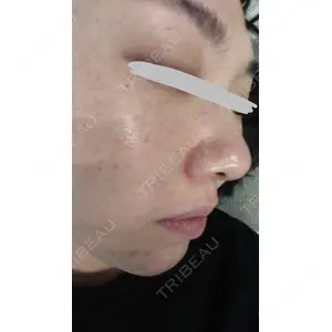 9BeautyClinic口コミ