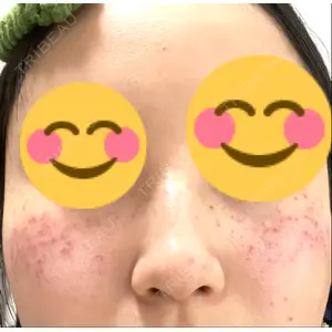 神楽坂美容クリニック タテバ芍薬口コミ