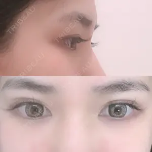 TCB東京中央美容外科 TCB東京中央美容外科 新宿東口院口コミ