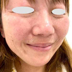 TCB東京中央美容外科 TCB東京中央美容外科 立川院口コミ