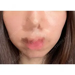 A CLINIC（エークリニック） A CLINIC（エークリニック） 横浜院口コミ