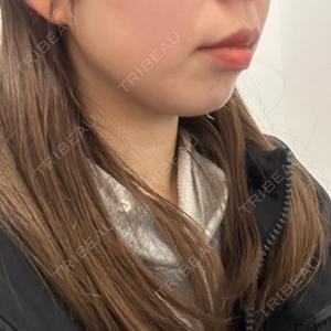 TCB東京中央美容外科 TCB東京中央美容外科 福岡天神院口コミ