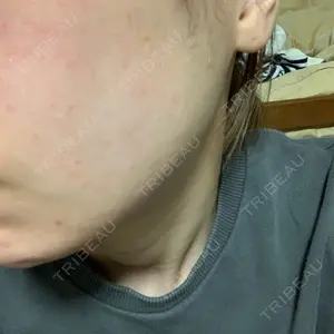 湘南美容クリニック 湘南美容クリニック 金山院口コミ
