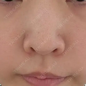口コミ