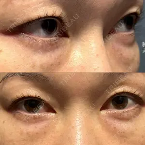 X CLINIC X CLINIC 銀座院口コミ