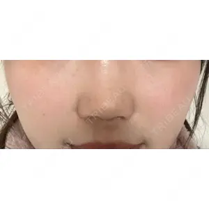 TCB東京中央美容外科 TCB東京中央美容外科 中野院口コミ