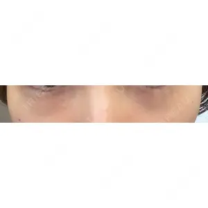 ギャラリークリニック ギャラリークリニック 銀座口コミ