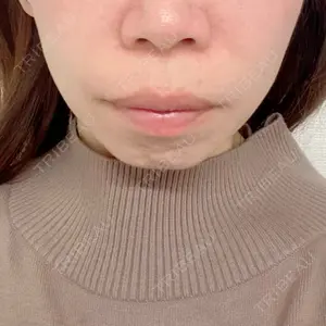 口コミ
