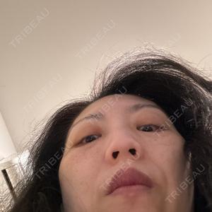 TCB東京中央美容外科 TCB東京中央美容外科 神戸院口コミ