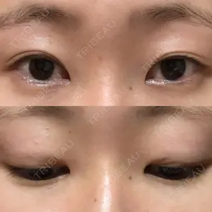 表参道スキンクリニック 表参道スキンクリニック 表参道院口コミ