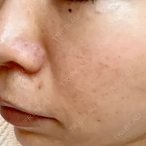 LIFIX BEAUTY CLINIC口コミ