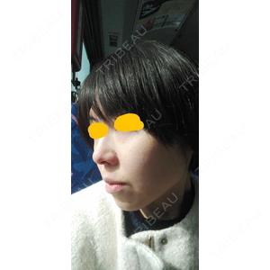 TCB東京中央美容外科 TCB東京中央美容外科 福岡博多院口コミ