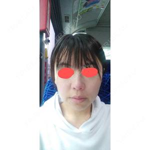 TCB東京中央美容外科 TCB東京中央美容外科 福岡博多院口コミ