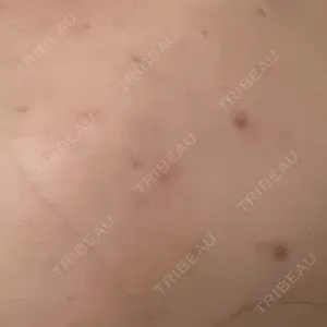 ARTE SKIN CLINIC 【アルテスキンクリニック】口コミ
