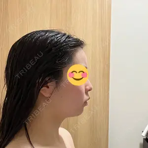 EMMO FACE CLINIC EMMO FACE CLINIC 大阪梅田院口コミ