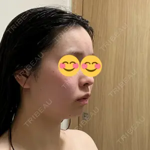 EMMO FACE CLINIC EMMO FACE CLINIC 大阪梅田院口コミ