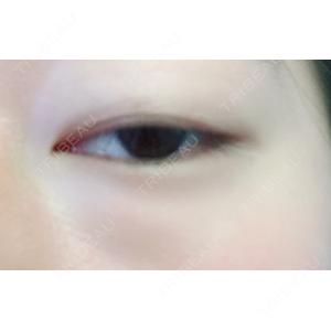 かめい美容クリニック宇都宮口コミ