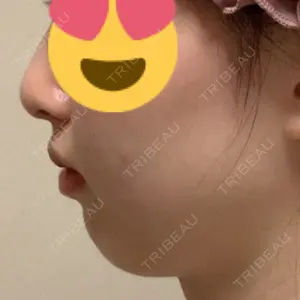 TCB東京中央美容外科 TCB東京中央美容外科 堺院口コミ