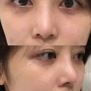 銀座みゆき通り美容外科 大阪梅田院の