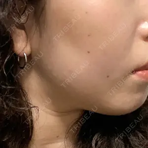 ルラ美容クリニック ルラ美容クリニック 高田馬場院口コミ