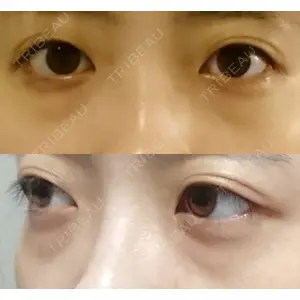 韓国ST美容整形外科口コミ