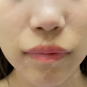 B-LINE CLINIC B-LINE CLINIC 大阪院口コミ