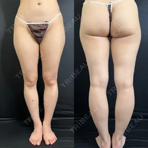 藤・ナチュレ美容クリニック 藤・ナチュレ美容クリニック 銀座院口コミ