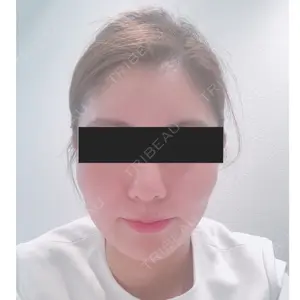 TCB東京中央美容外科 TCB東京中央美容外科 中野院口コミ