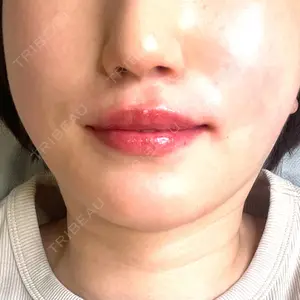 口コミ