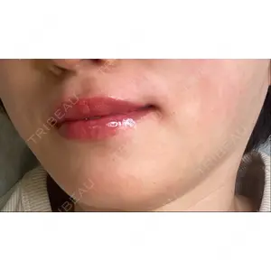 口コミ