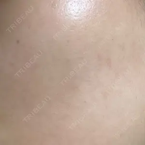 A CLINIC（エークリニック） A CLINIC（エークリニック） 横浜院口コミ