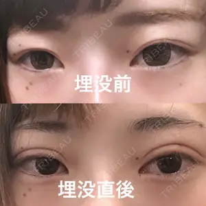 口コミ